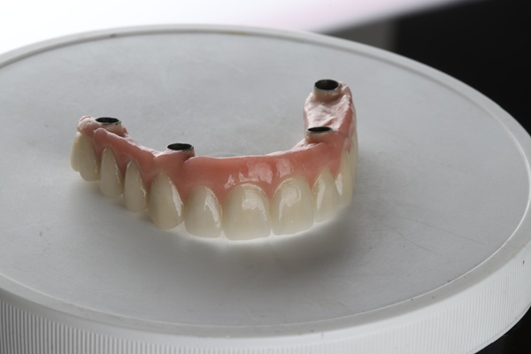 Do All On  ® Implants Look Natural?