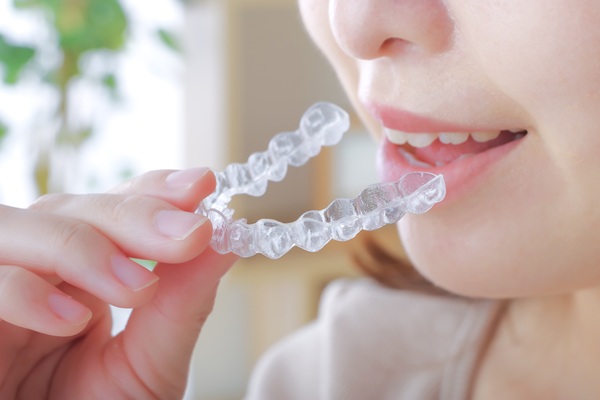 Invisalign Vs  Lingual Braces