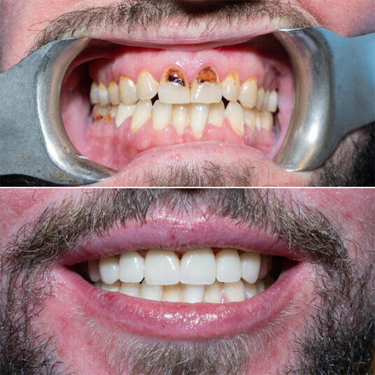 Dentist in Totowa, NJ Smile Gallery b Dental Spa at Totowa Before